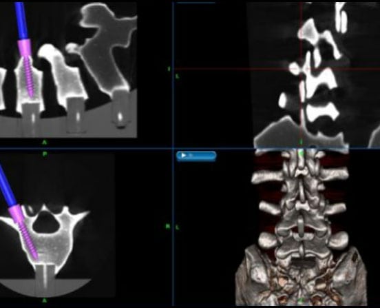 benefits of computer assisted