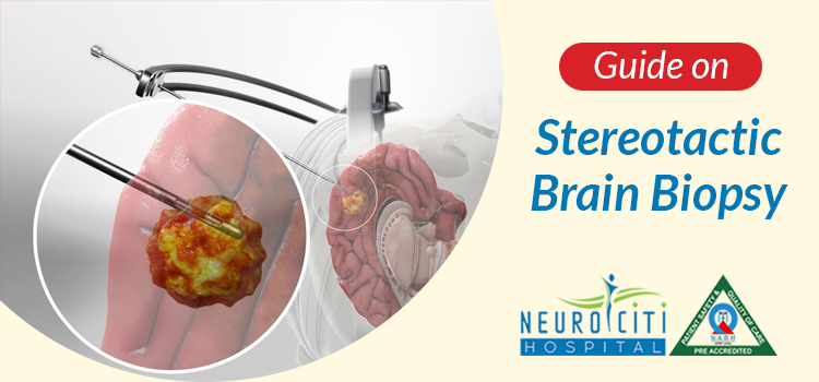 Guide on Stereotactic Brain Biopsy