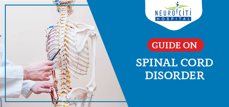 Everything you need to know about the spinal cord disorder treatment
